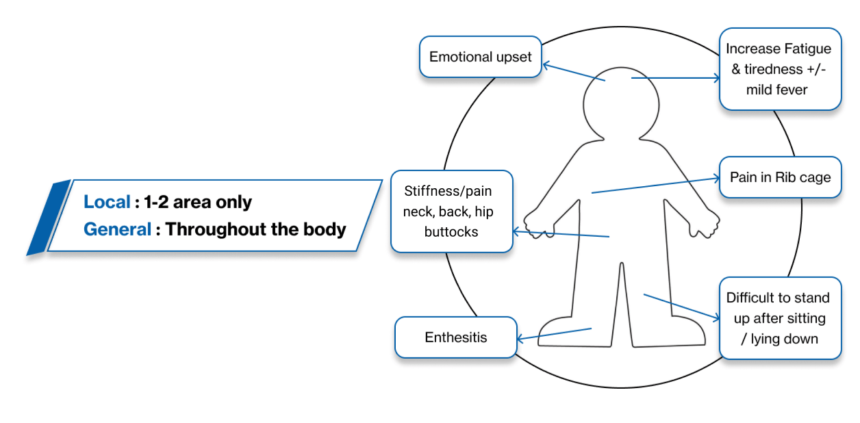 Ankylosing Spondylitis Flares